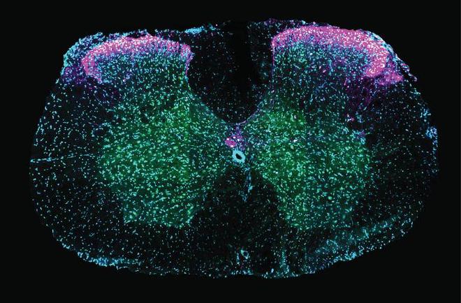 Corte transversal de la médula espinal que muestra las neuronas implicadas en la eyaculación. Las células marcadas en rosa (neuronas que expresan galanina) se superponen con las de color verde (señal de actividad reciente), lo que indica que estas neuronas están activas durante la eyaculación. El azul marca todas las neuronas como guía visual. Crédito de la imagen: Neuroethology Lab, Champalimaud Foundation