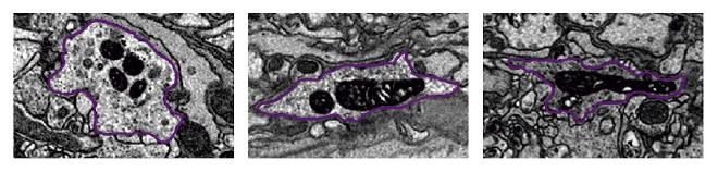 Imágenes de microscopía electrónica de una neurona “reloj” de Drosophila, tomadas a la mañana, a la noche y antes del amanecer (de izquierda a derecha). En negro oscuro se pueden ver las mitocondrias y cómo cambian la cantidad y su forma a medida que avanza el día. Crédito de la imagen: Rodríguez-Caron, Ispizua et al.